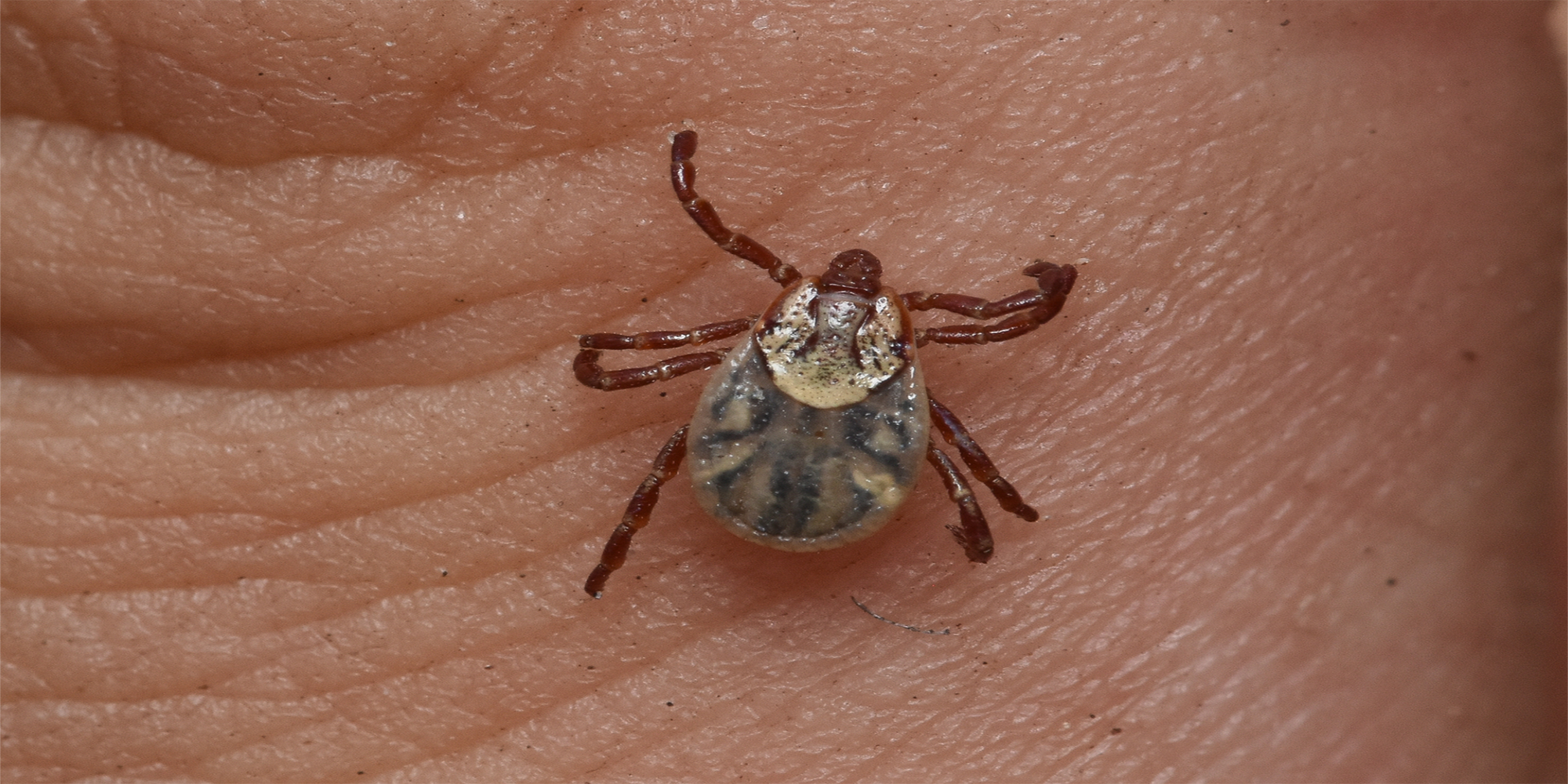 An American dog tick on someone's hand.